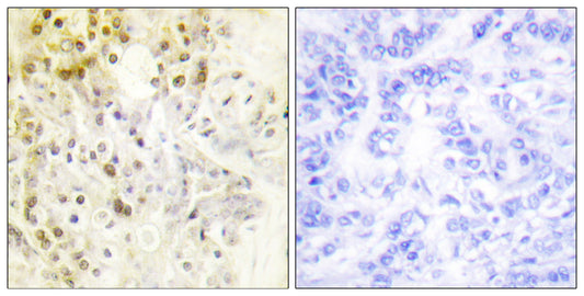 Cyclin L1 Rabbit Polyclonal Antibody
