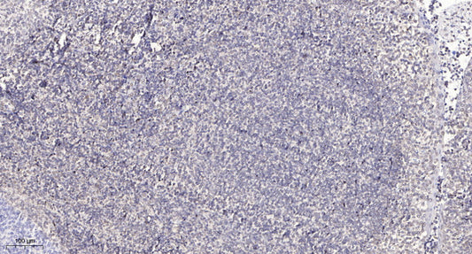 Cyclin T2 Rabbit Polyclonal Antibody
