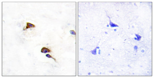 Cyclophilin F Rabbit Polyclonal Antibody