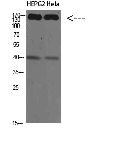 CYFIP2 Rabbit Polyclonal Antibody