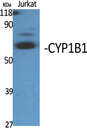 CYP1B1 Rabbit Polyclonal Antibody