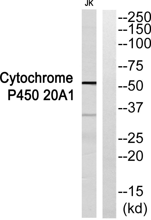 CYP20A1 Rabbit Polyclonal Antibody