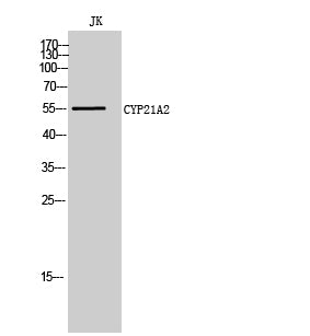 CYP21A2 Rabbit Polyclonal Antibody