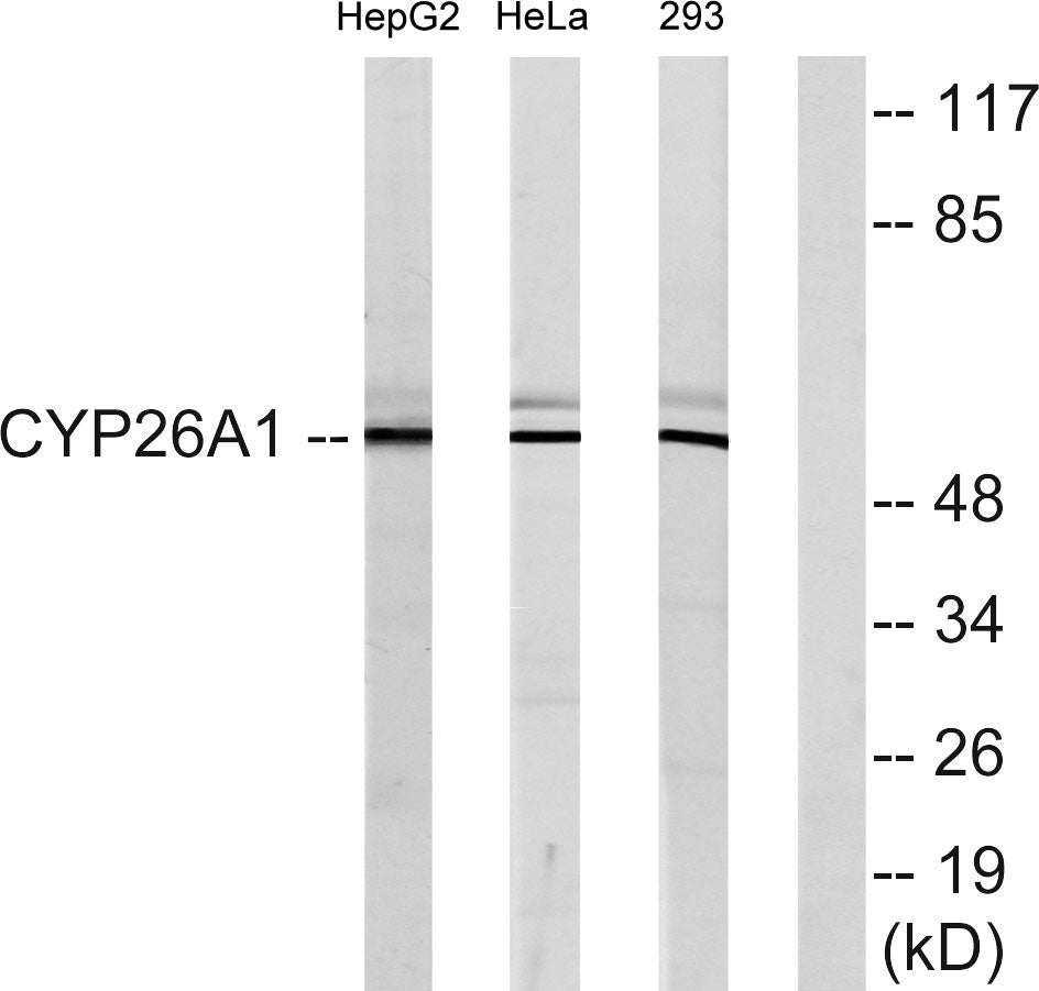 CYP26A1 Rabbit Polyclonal Antibody