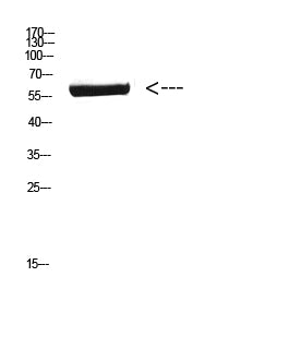 CYP26B1 Rabbit Polyclonal Antibody
