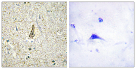 CYP26C1 Rabbit Polyclonal Antibody