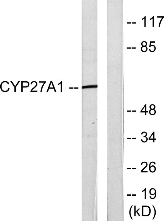 CYP27A1 Rabbit Polyclonal Antibody