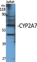 CYP2A7 Rabbit Polyclonal Antibody