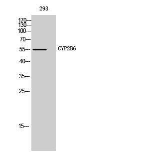 CYP2B6 Rabbit Polyclonal Antibody