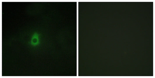 CYP2E1 Rabbit Polyclonal Antibody