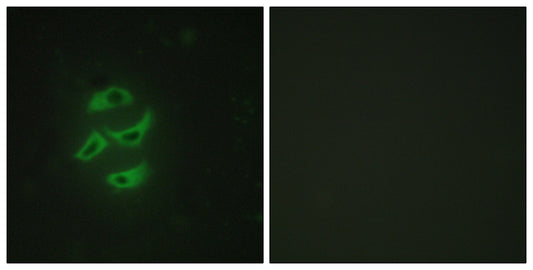 CYP2J2 Rabbit Polyclonal Antibody