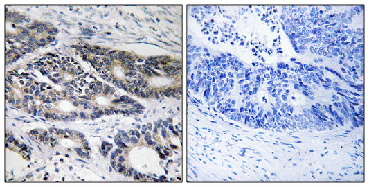 CYP2R1 Rabbit Polyclonal Antibody
