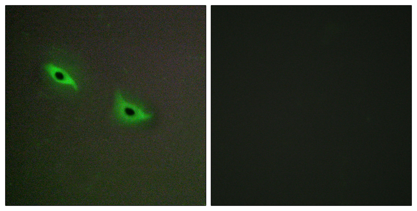 CYP2S1 Rabbit Polyclonal Antibody