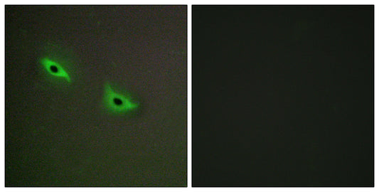 CYP2S1 Rabbit Polyclonal Antibody