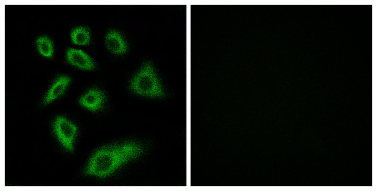 CYP2W1 Rabbit Polyclonal Antibody
