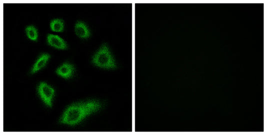 CYP2W1 Rabbit Polyclonal Antibody