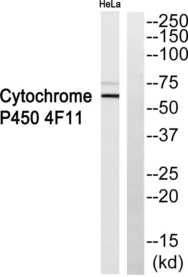 CYP4F11 Rabbit Polyclonal Antibody
