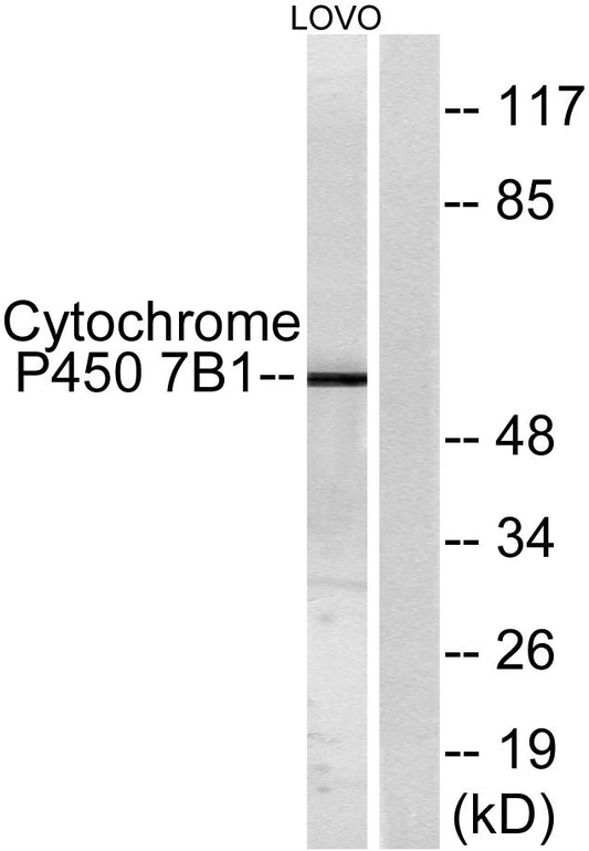 CYP7B1 Rabbit Polyclonal Antibody