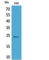 CyPB Rabbit Polyclonal Antibody