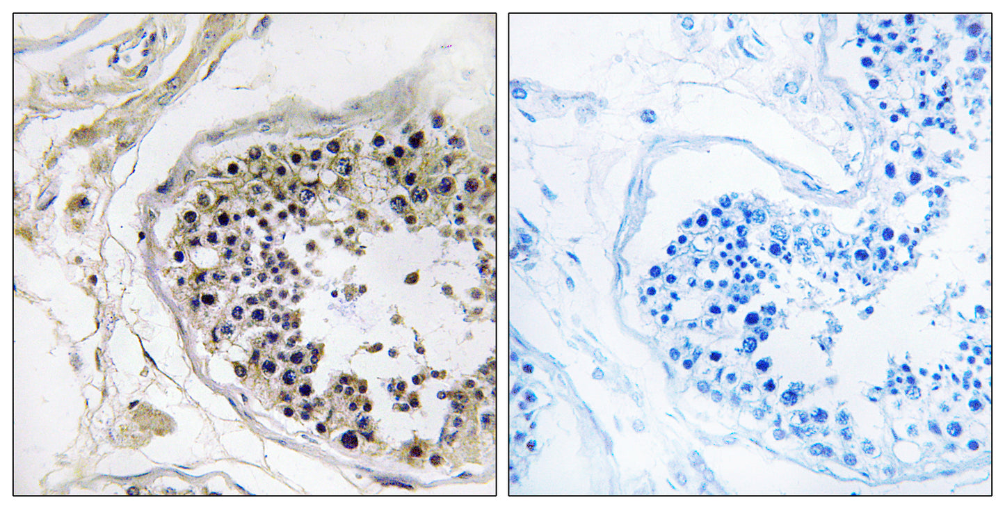 Cystatin 8 Rabbit Polyclonal Antibody