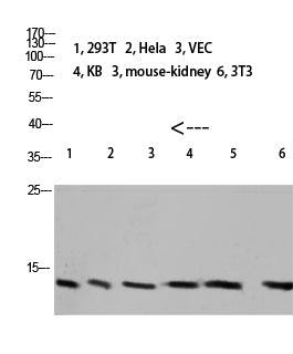 Cystatin A Rabbit Polyclonal Antibody
