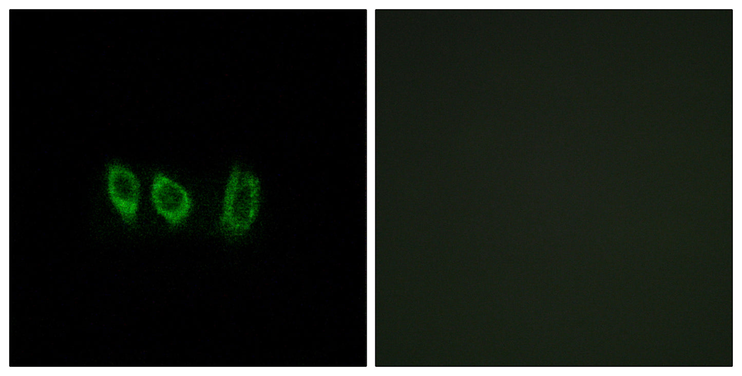 Cystatin L1 Rabbit Polyclonal Antibody