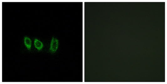 Cystatin L1 Rabbit Polyclonal Antibody