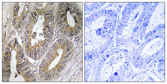 Cystatin SA Rabbit Polyclonal Antibody