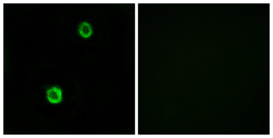 Cystatin SN Rabbit Polyclonal Antibody