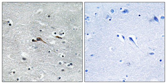CYTL1 Rabbit Polyclonal Antibody