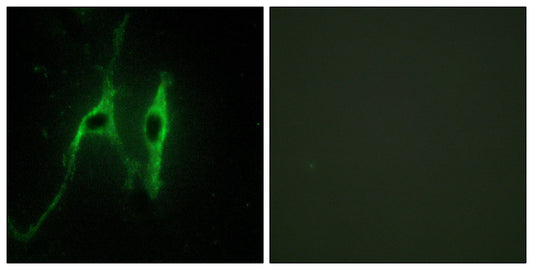 Cytochrome b5 Rabbit Polyclonal Antibody