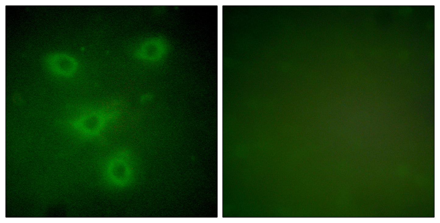 Cytokeratin 14/16 Rabbit Polyclonal Antibody