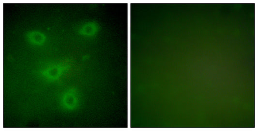 Cytokeratin 14/16 Rabbit Polyclonal Antibody