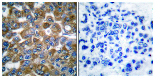 Cytokeratin 15 Rabbit Polyclonal Antibody