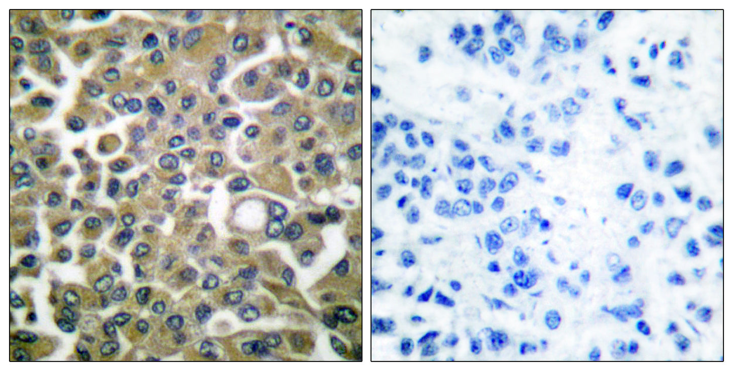 Cytokeratin 16 Rabbit Polyclonal Antibody