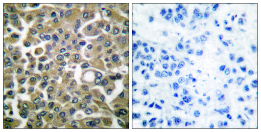 Cytokeratin 16 Rabbit Polyclonal Antibody