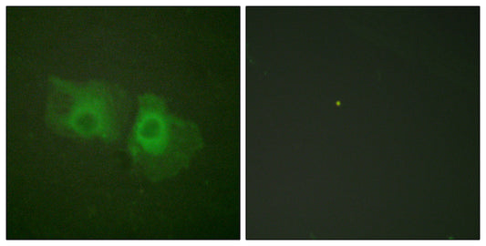 Cytokeratin 18 Rabbit Polyclonal Antibody