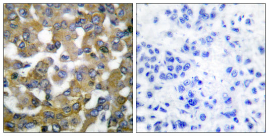 Cytokeratin 19 Rabbit Polyclonal Antibody