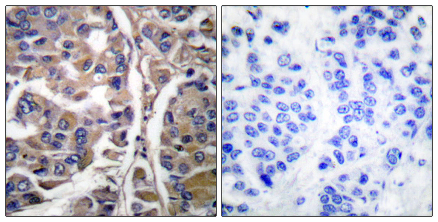 Cytokeratin 20 Rabbit Polyclonal Antibody