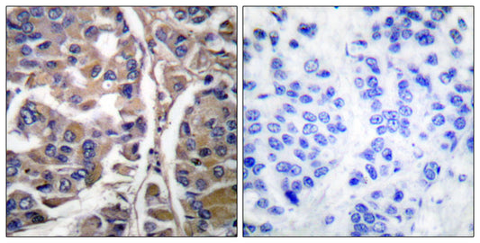 Cytokeratin 20 Rabbit Polyclonal Antibody