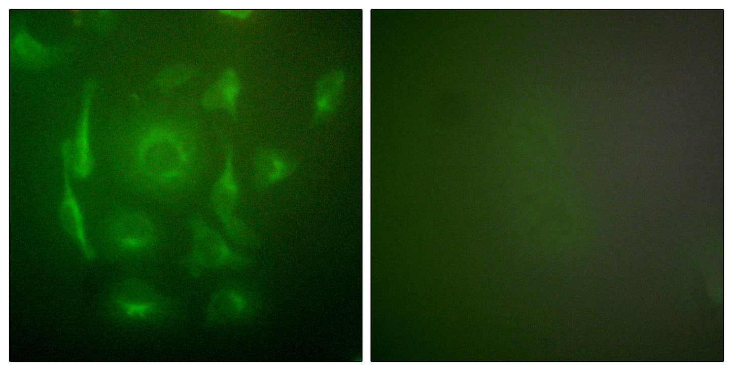 Cytokeratin 7 Rabbit Polyclonal Antibody