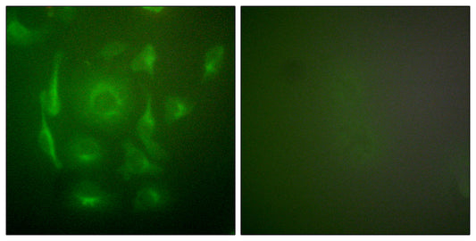 Cytokeratin 7 Rabbit Polyclonal Antibody