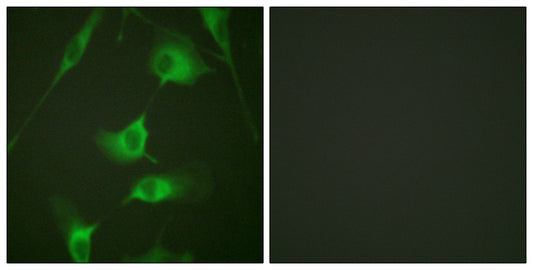 Cytokeratin 8 Rabbit Polyclonal Antibody