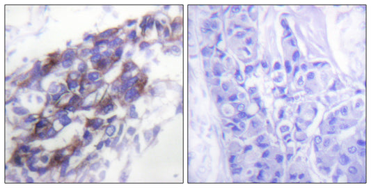 Cytokeratin 8 Rabbit Polyclonal Antibody