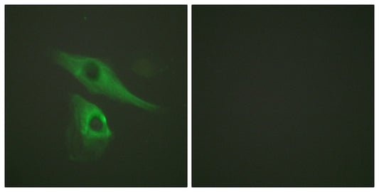 Cytokeratin 8 Rabbit Polyclonal Antibody