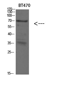 Cytokeratin 4 Rabbit Polyclonal Antibody