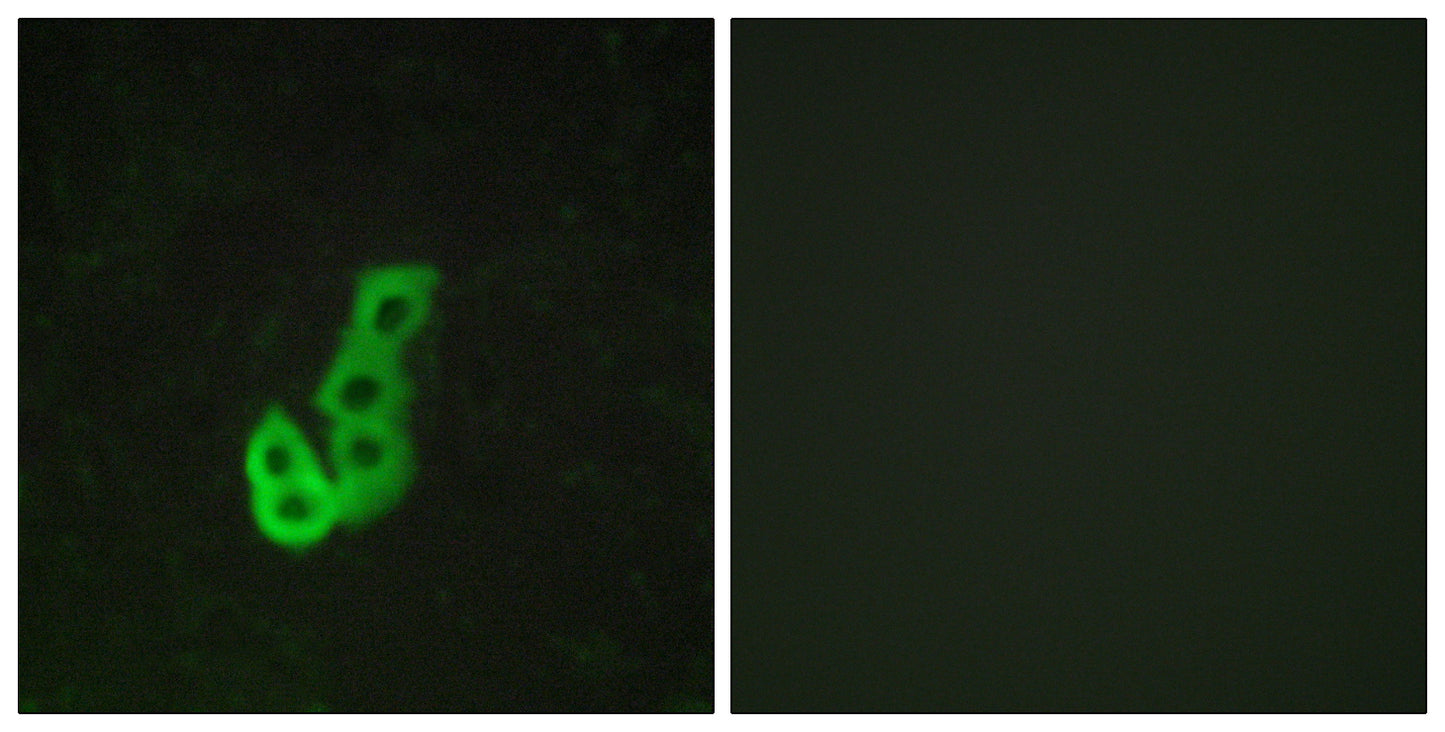 D1DR Rabbit Polyclonal Antibody