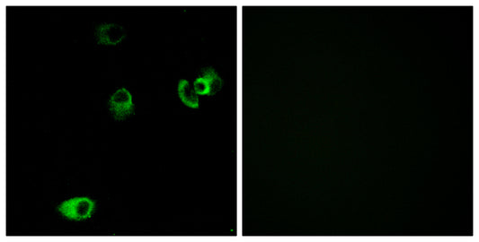 D4DR Rabbit Polyclonal Antibody