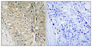 D55 Rabbit Polyclonal Antibody