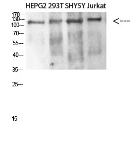 DAAM1 Rabbit Polyclonal Antibody